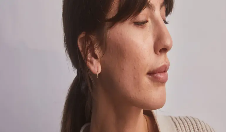 Choosing the right skincare routine